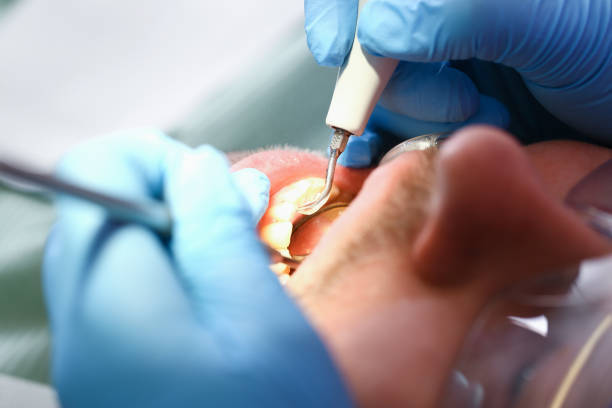 Best Emergency Treatment for Jaw Pain or Injury in West Hollywood, CA